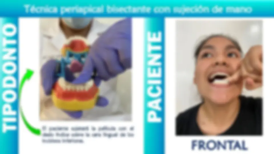 pfe