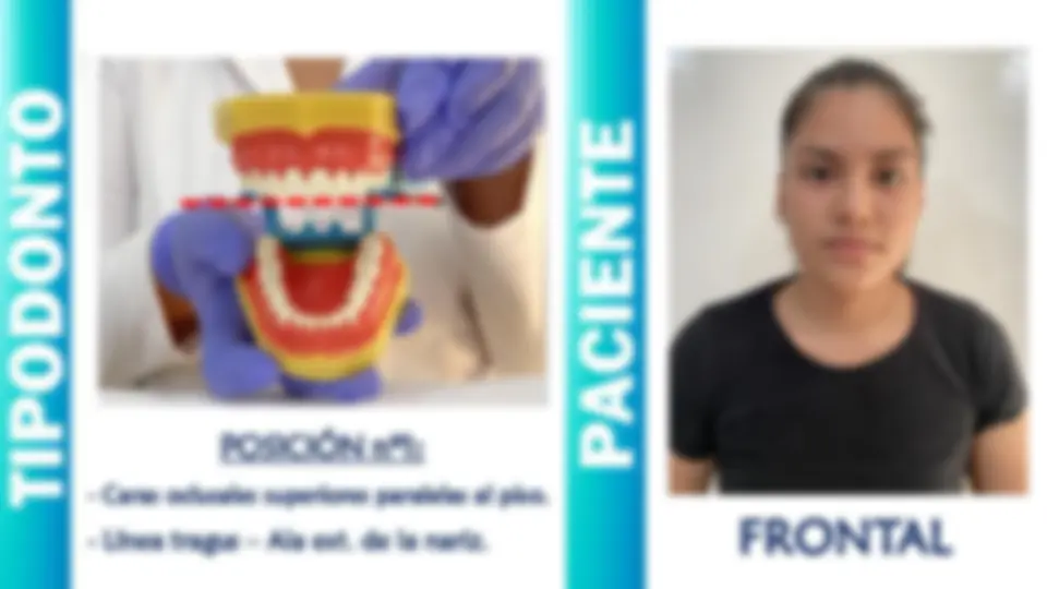 pf4