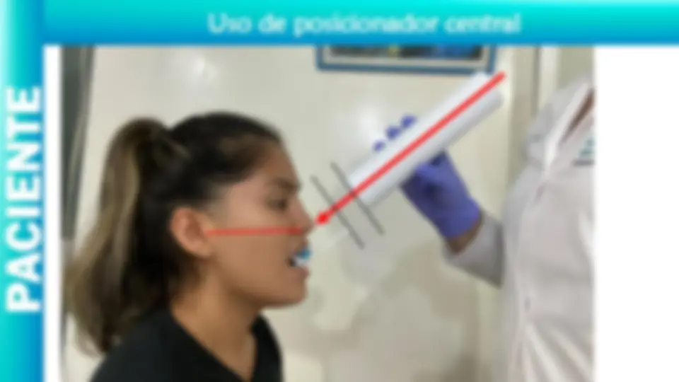 pfa