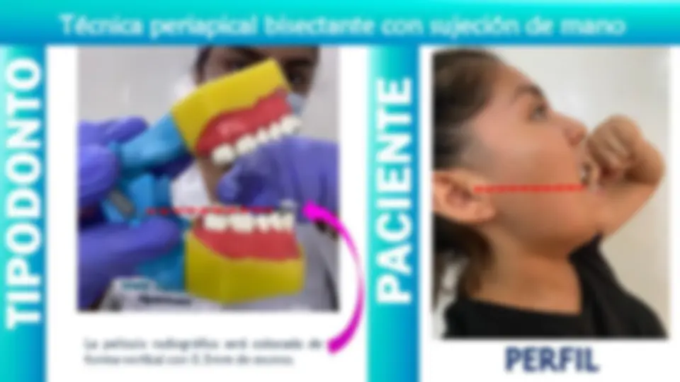pff