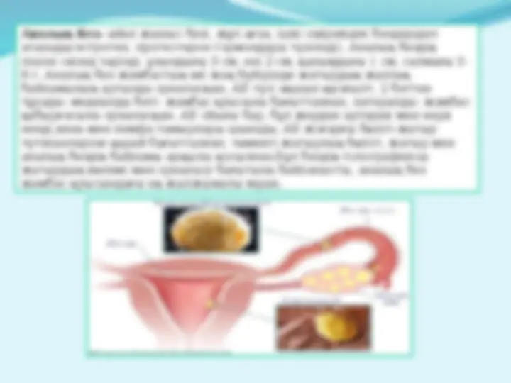 Кленов қаласындағы Суретшілер одағының мүшесі Үлкен есек қыздармен порно секс