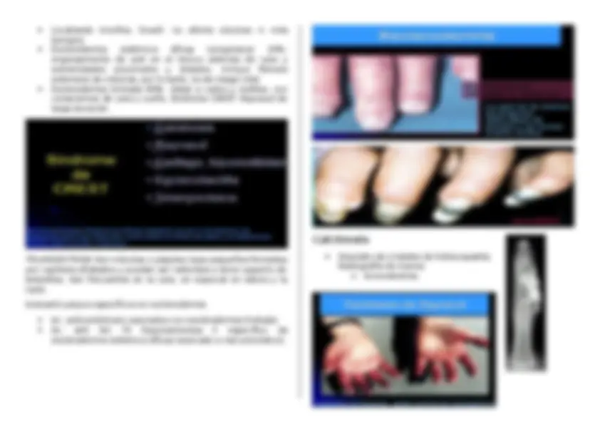 pf9