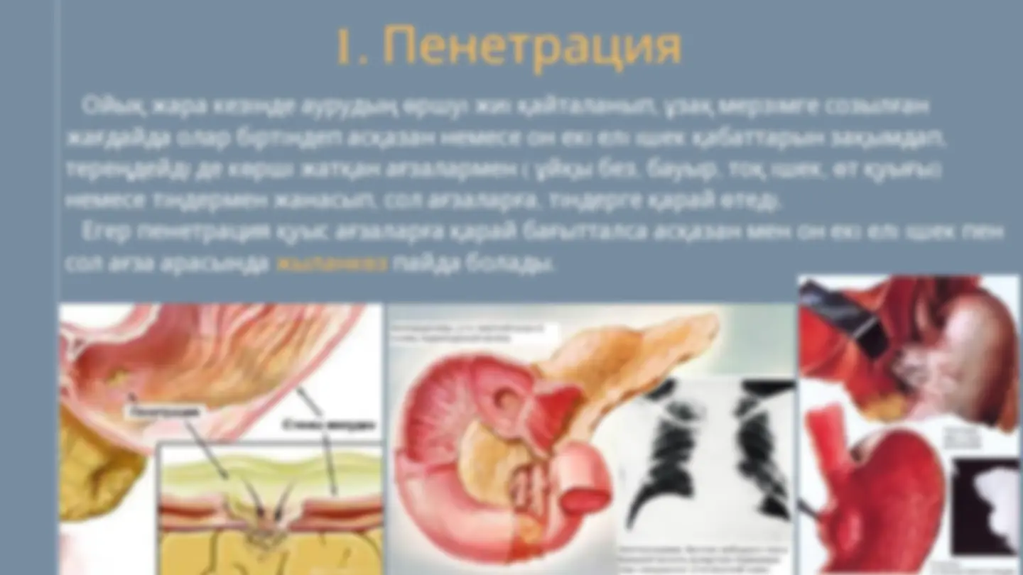 Жалаңаш Венди Фиоре