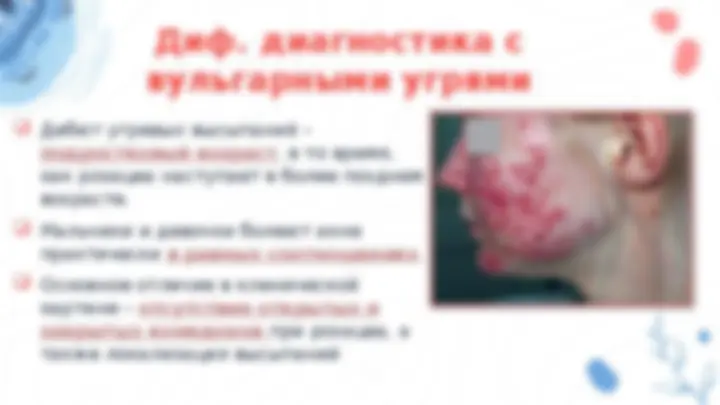 pf13