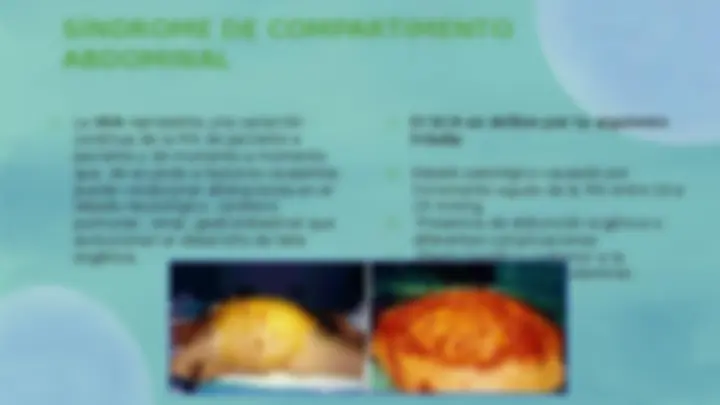 pfa