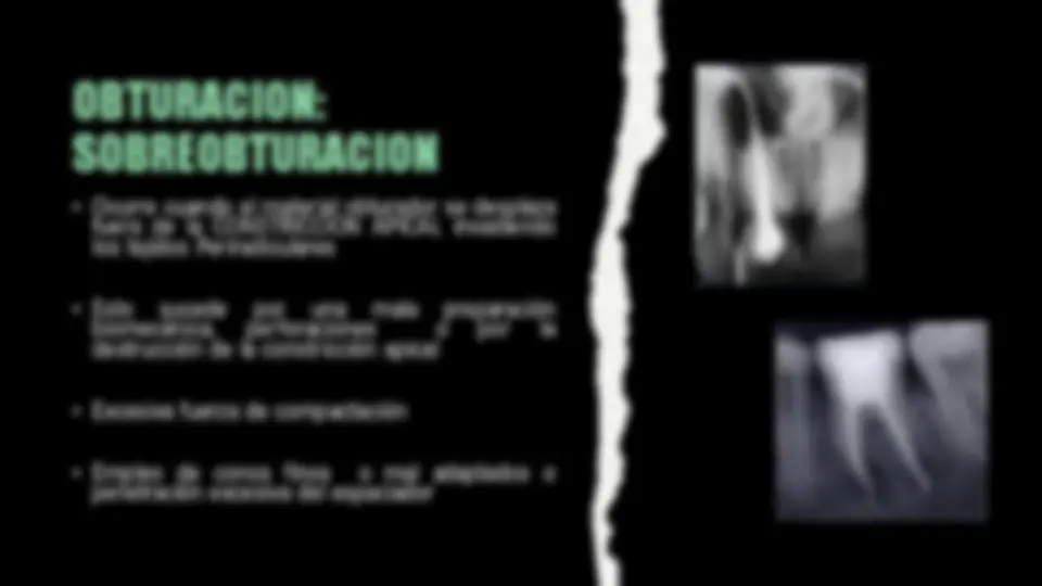 pf14