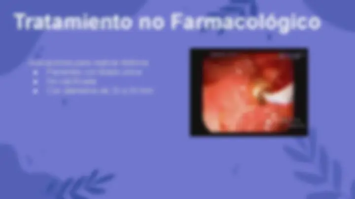 pf30