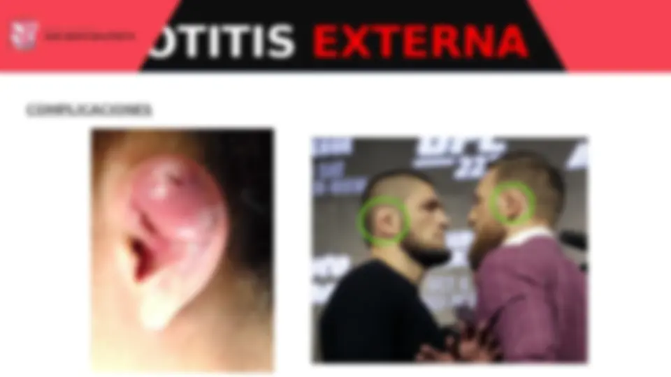 pfe