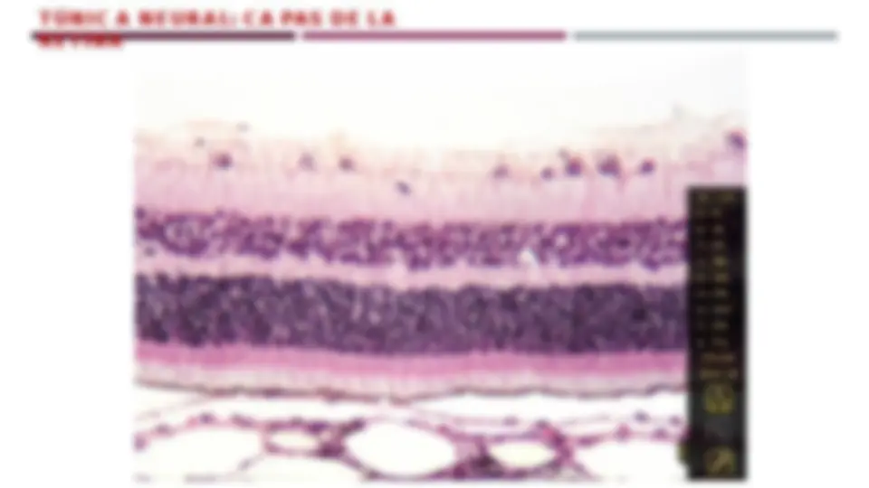 pf25