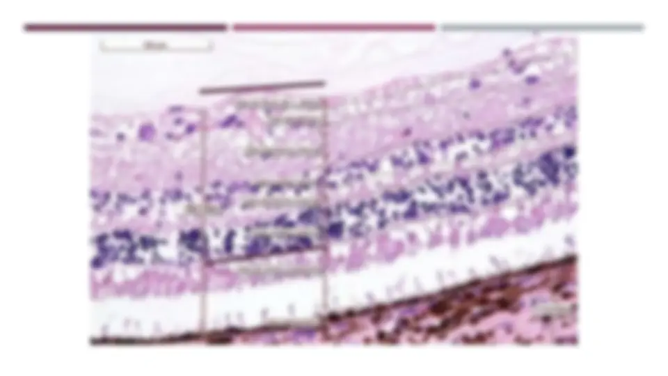 pf27