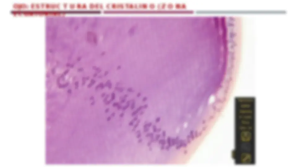pf21