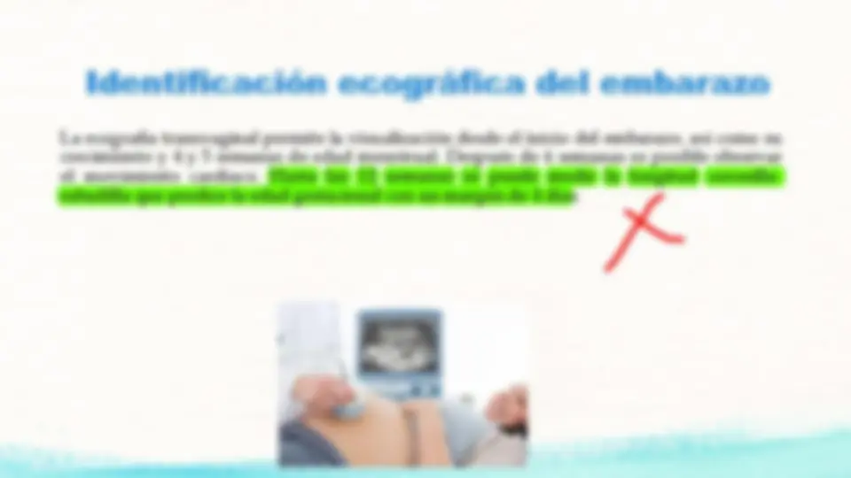 pfe