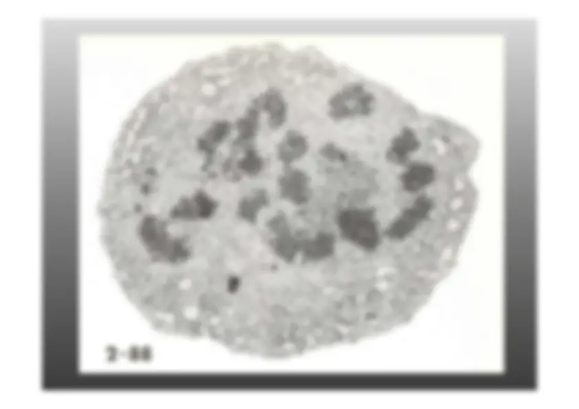 pf21