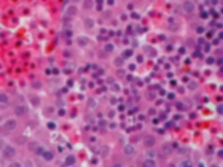 pf39