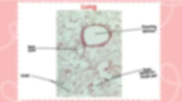pf5