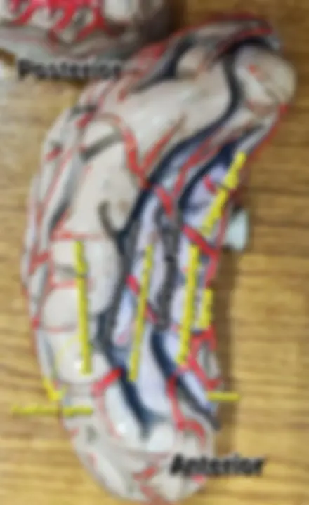 pf3