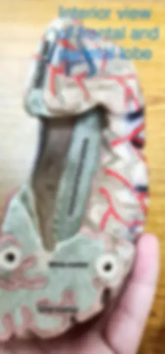pf5
