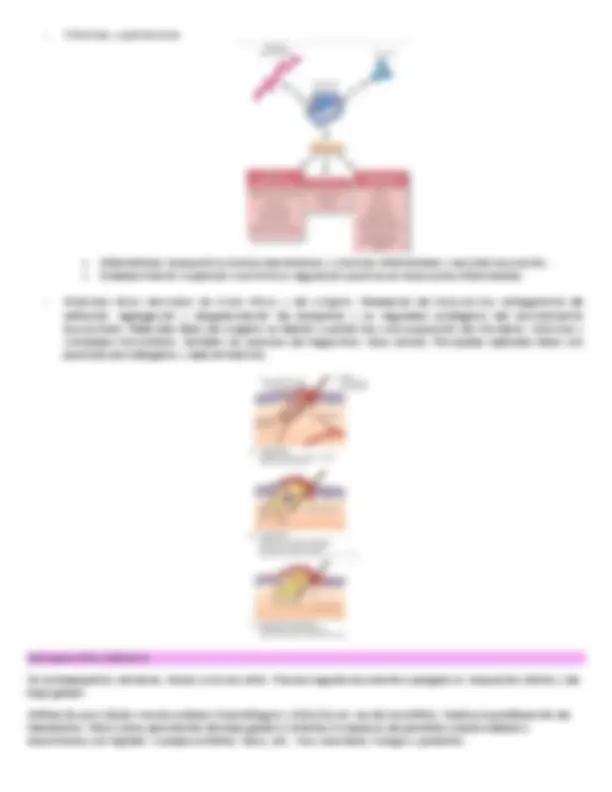 Inflamación Aguda: Fases, Células y Mecanismos | Esquemas y mapas ...