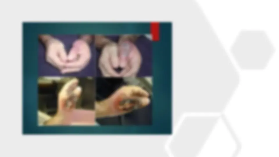 pf3b