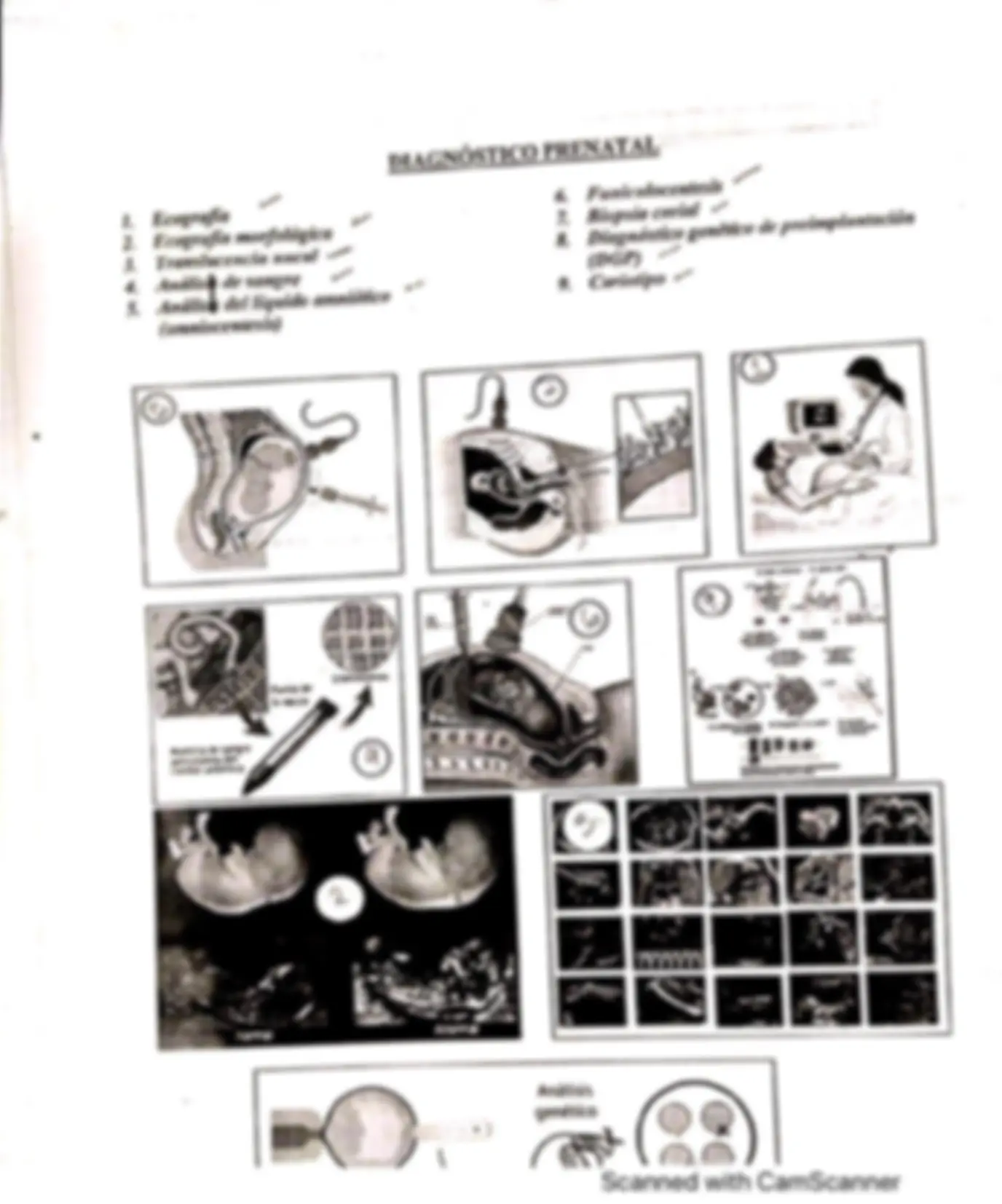 pf27