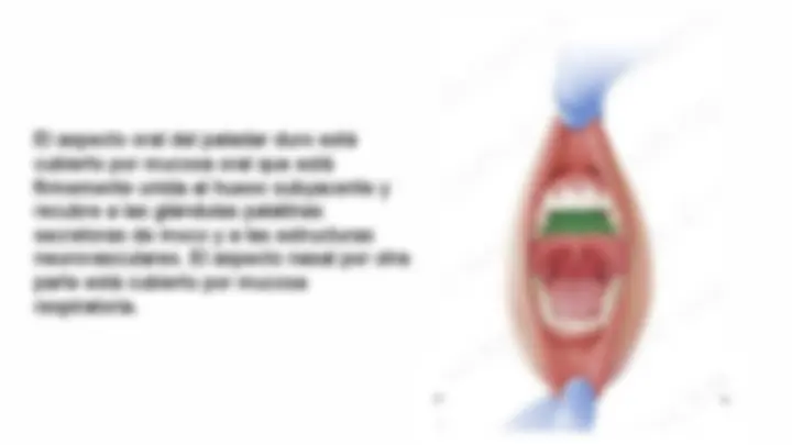 pf13