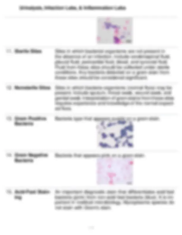 Urinalysis and Infection Labs: Understanding Urine Tests for Diagnostic ...
