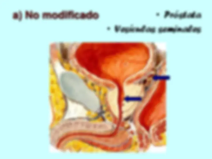 pf37