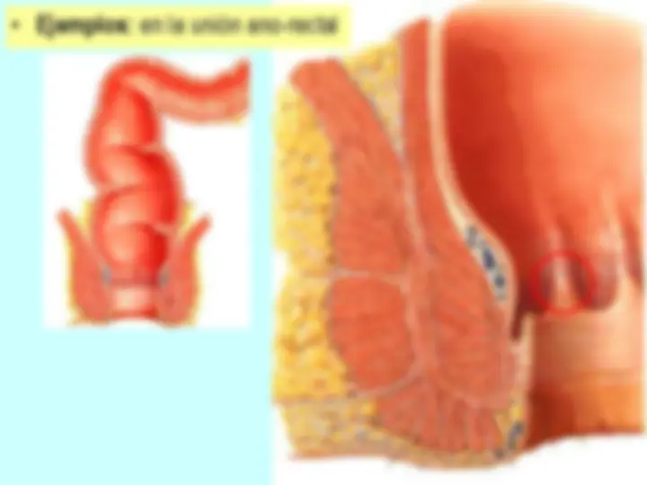 pf57