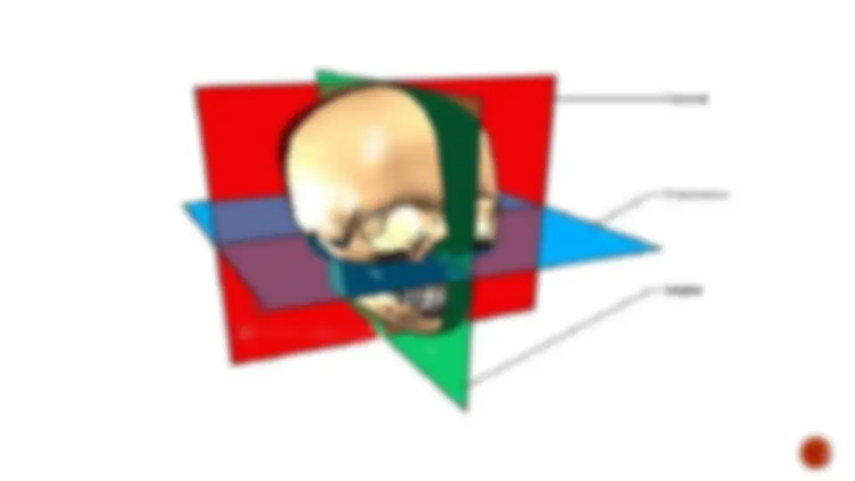 pfe