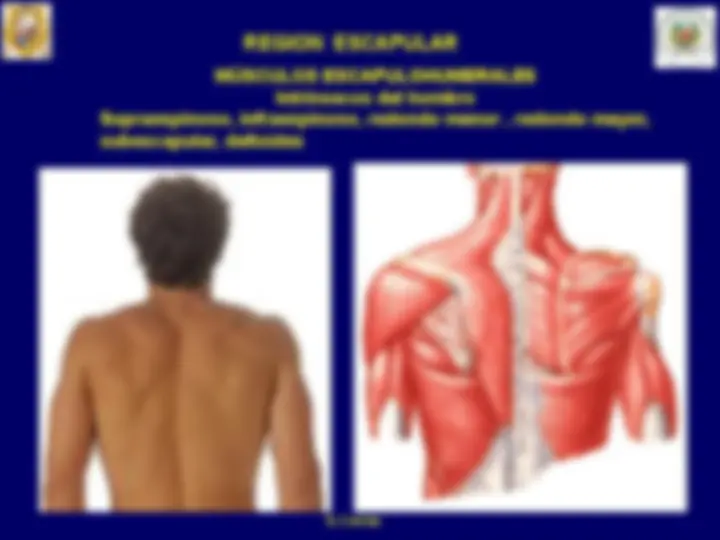 pf21