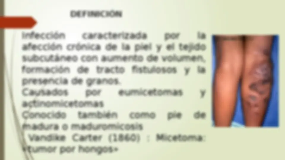 pf26