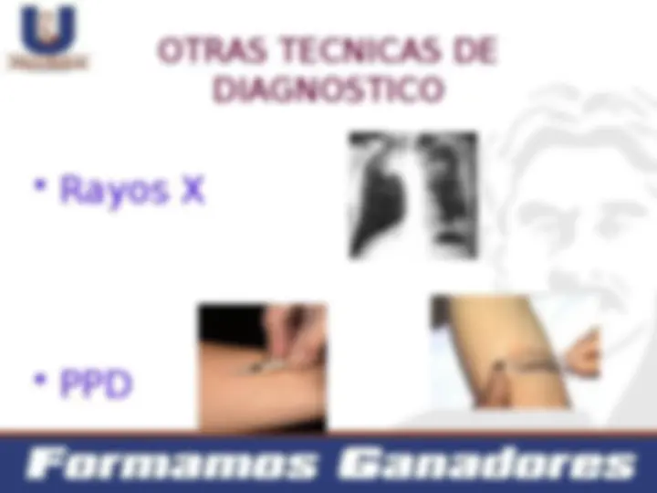 pf17