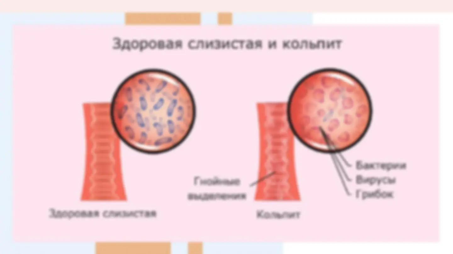 Жапон қыздарының есектерінің суреттері