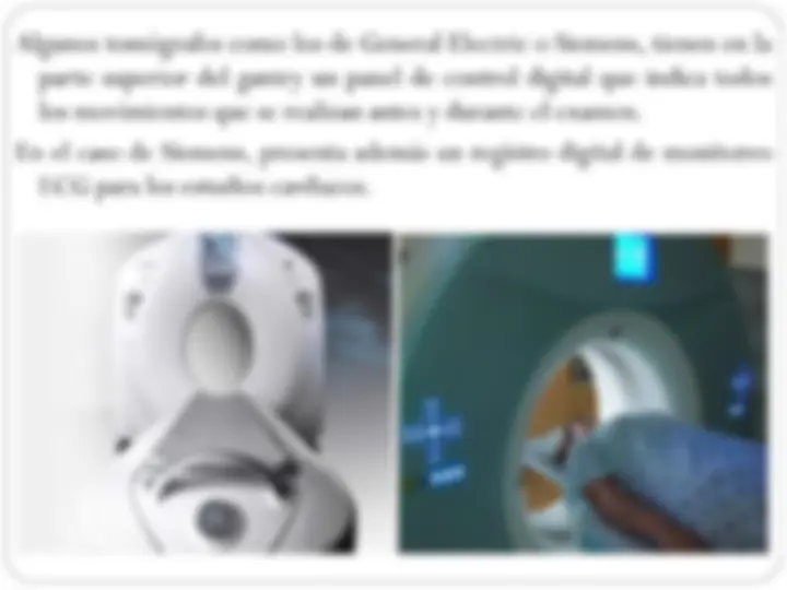 pfe