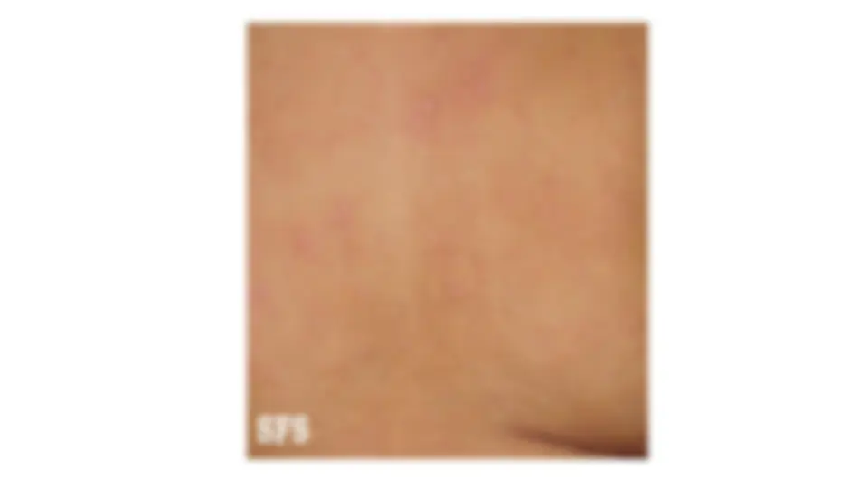 pf25