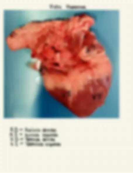 pf4