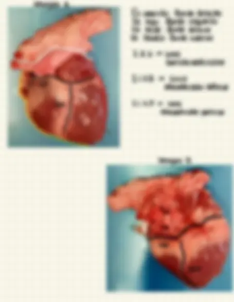 pf5