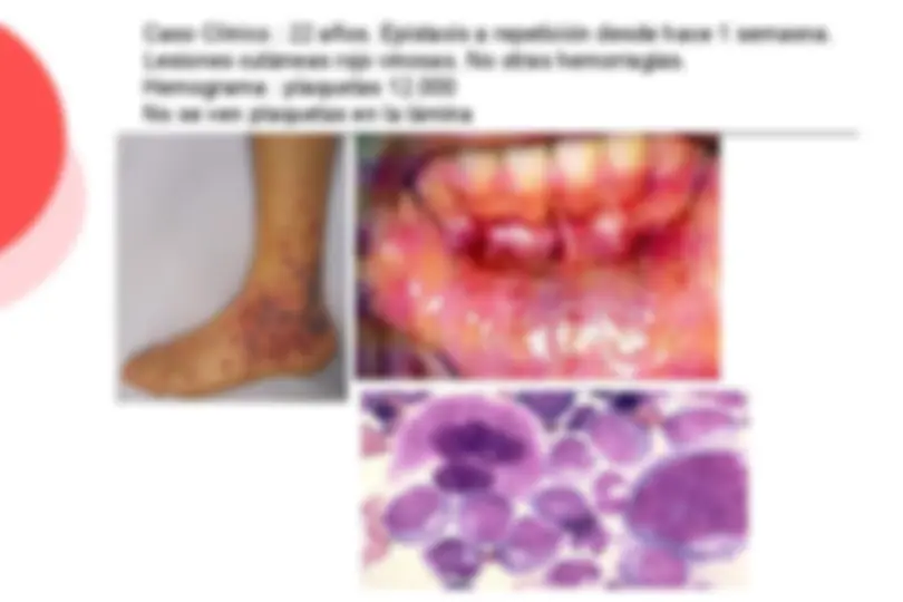 pf3f