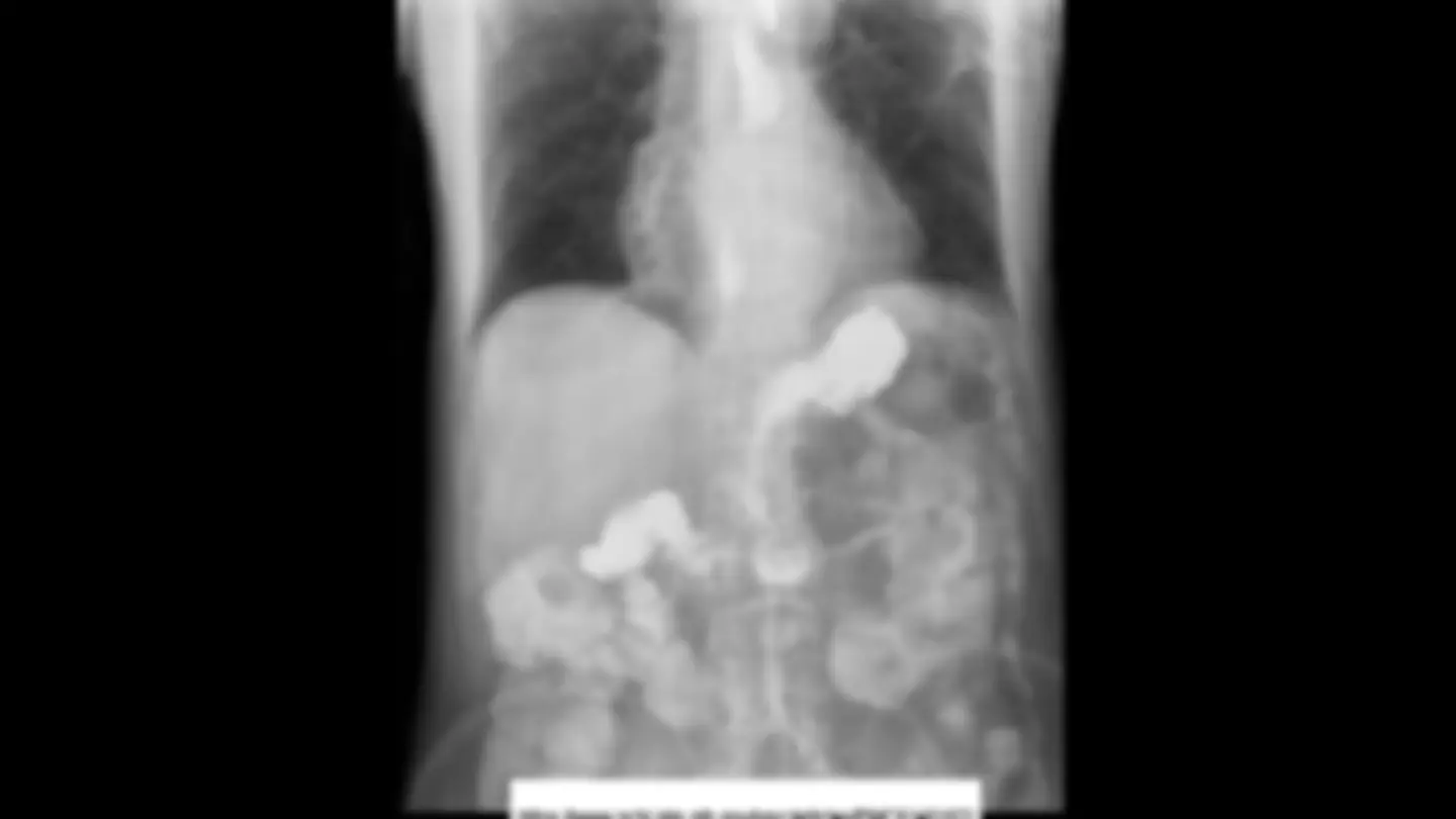 pfa