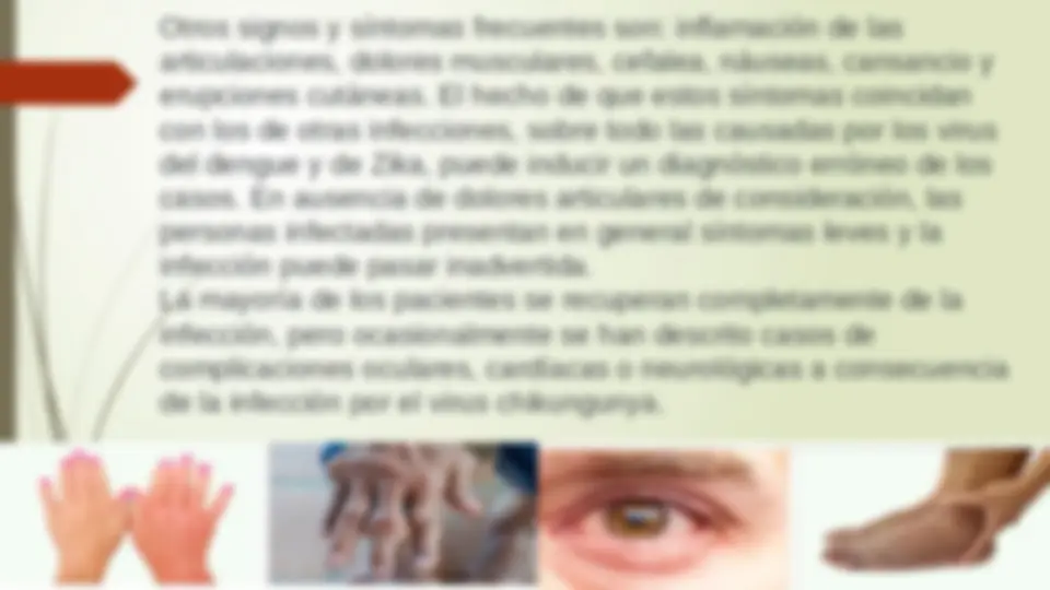 pfe