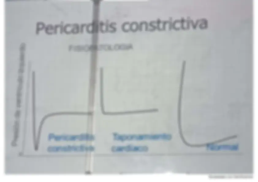 pf3c