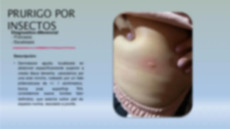 pfe
