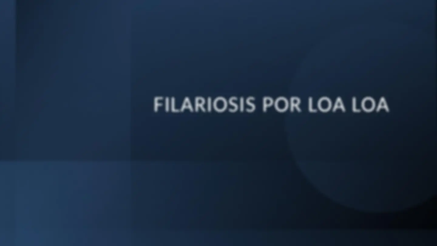 pfd
