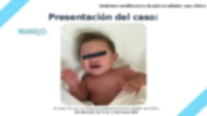 pfd