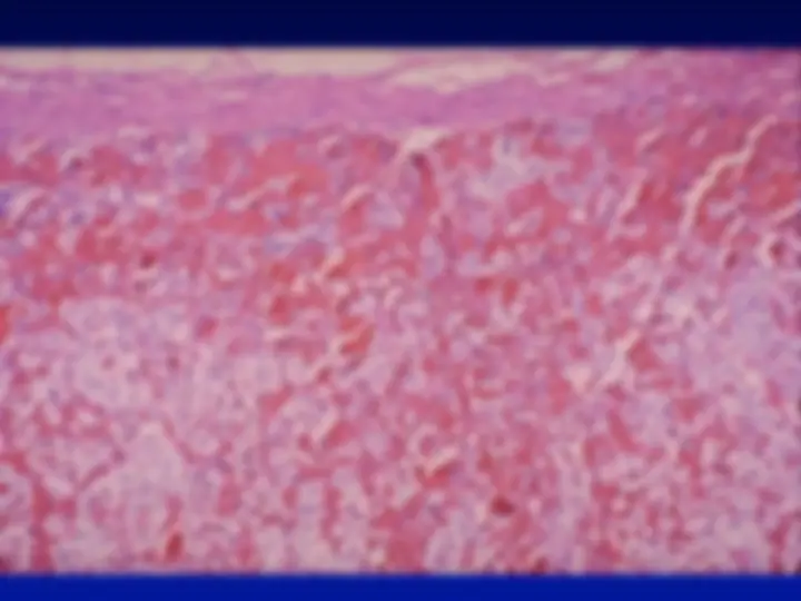 pf33