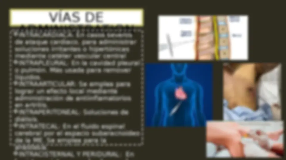 pfa