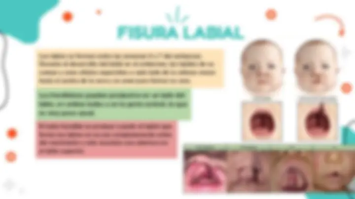pfa