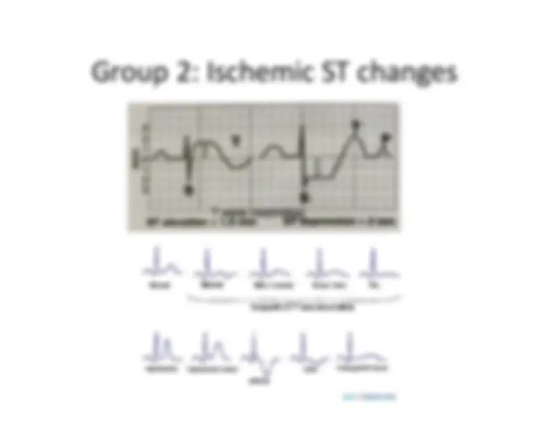 pf12