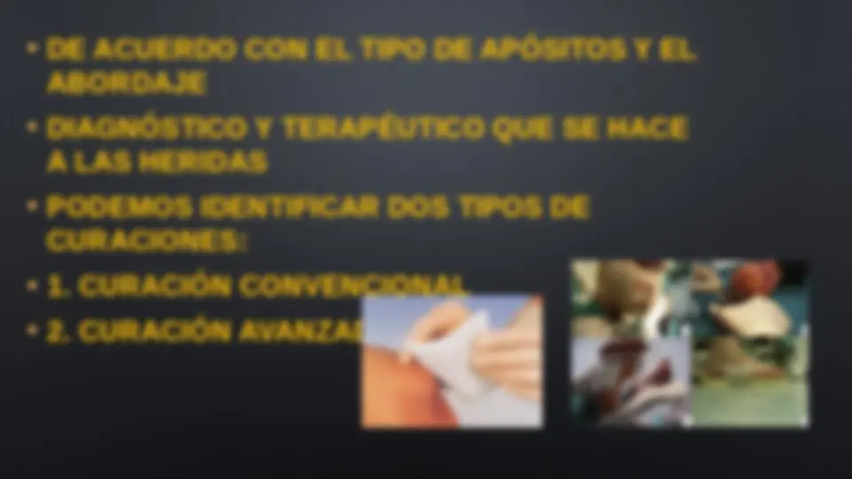 pfe