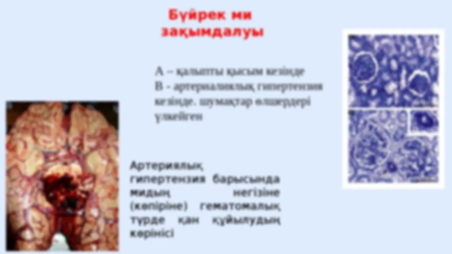 Үлкен сиськи мен есектерді қараңыз